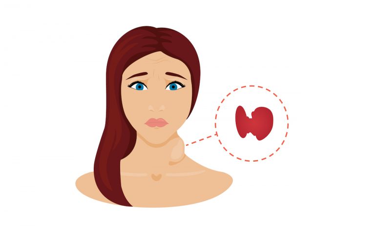 What Does It Mean When You Have A Goiter On Your Thyroid